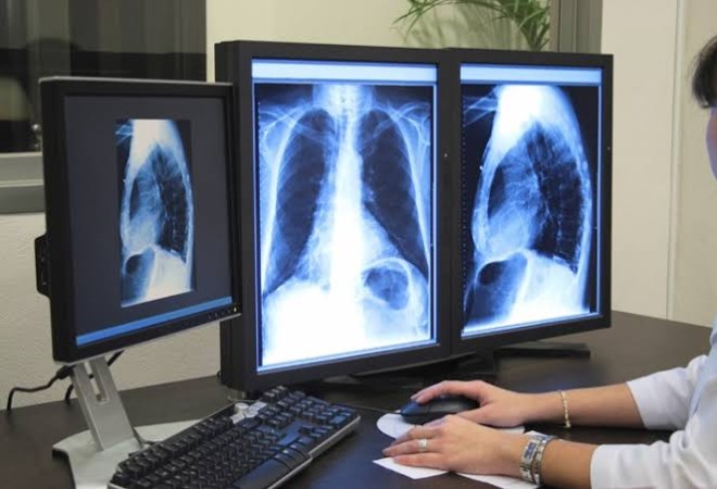 O Instituto Patris convida todos os interessados para participarem da licitação que visa contratação de serviços em radiologia e diagnóstico por imagens
